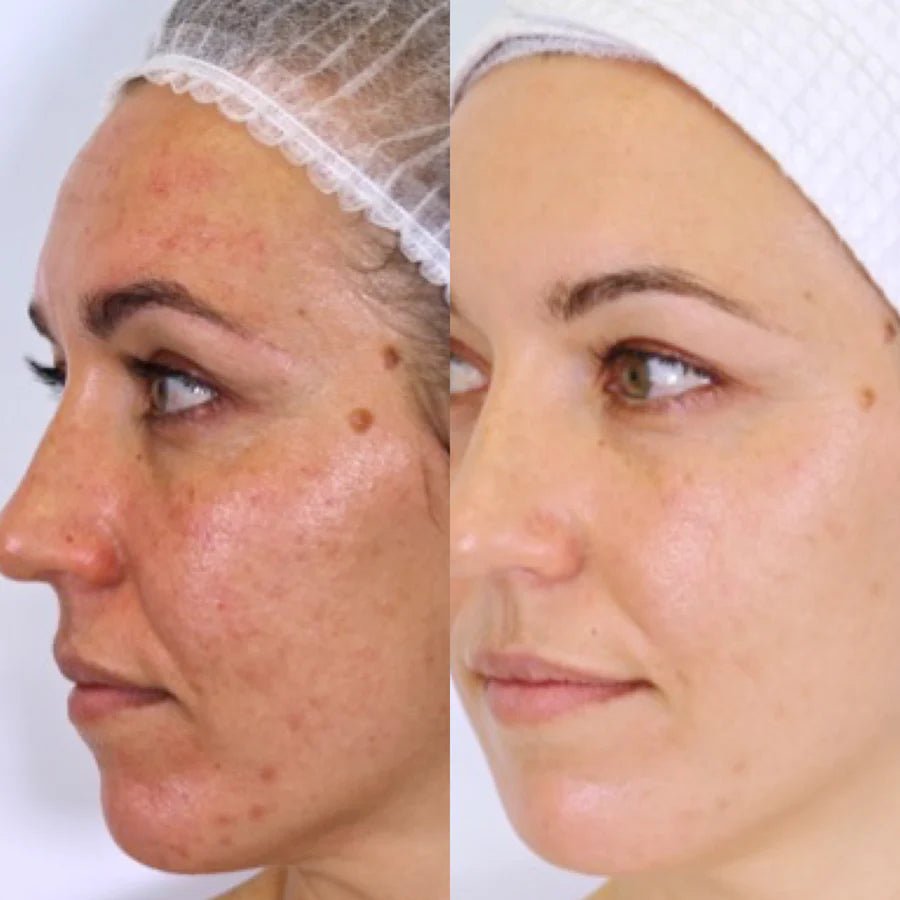 The Holy Trinity Daily Skincare Routine - Trial Pack