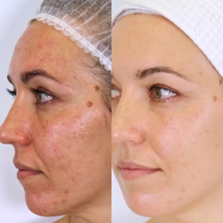 The Holy Trinity Daily Skincare Routine - Trial Pack